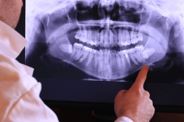 Best Broken or Cracked Tooth Emergency Dentist in West Jefferson, NC