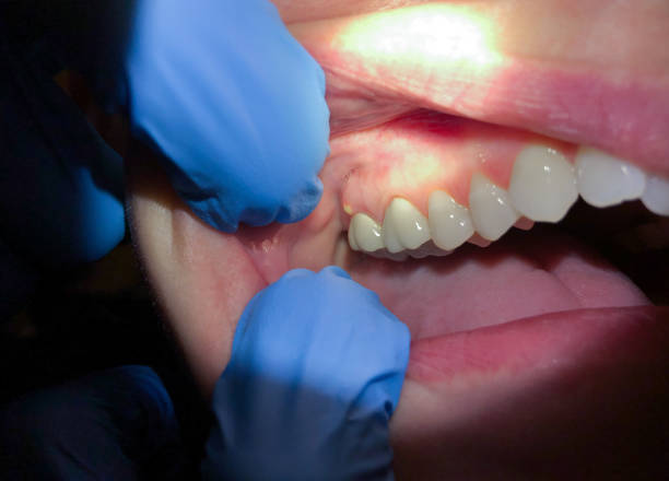 Best Orthodontic Emergency Dentist in West Jefferson, NC