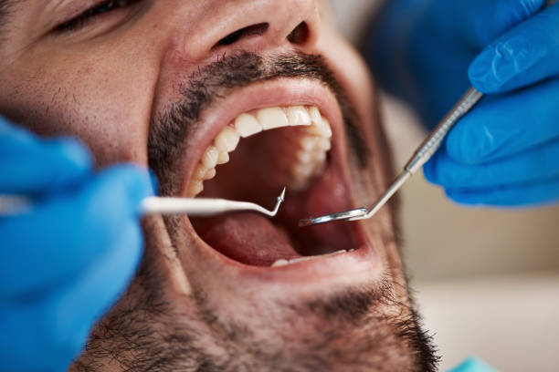 Best Emergency Dentist for Special Needs Patients in West Jefferson, NC