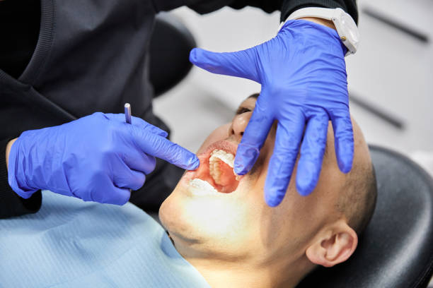 Best Emergency Dentist for Lost Fillings or Crowns in West Jefferson, NC